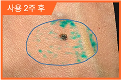 사용 후 피부 각질